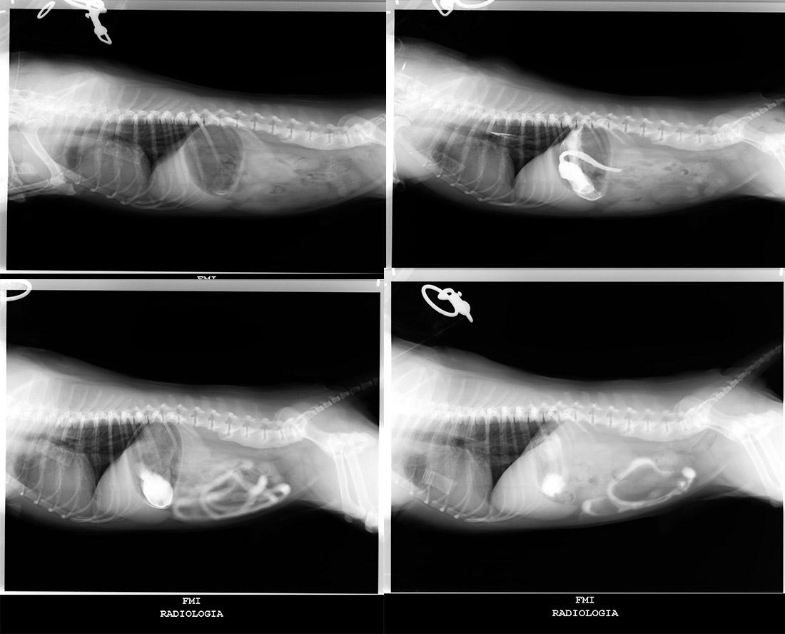 radiografia1